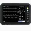 Yonker Multipara Patient Monitor- ECG, NIBP, RESP, PR, SPo2, TEMP