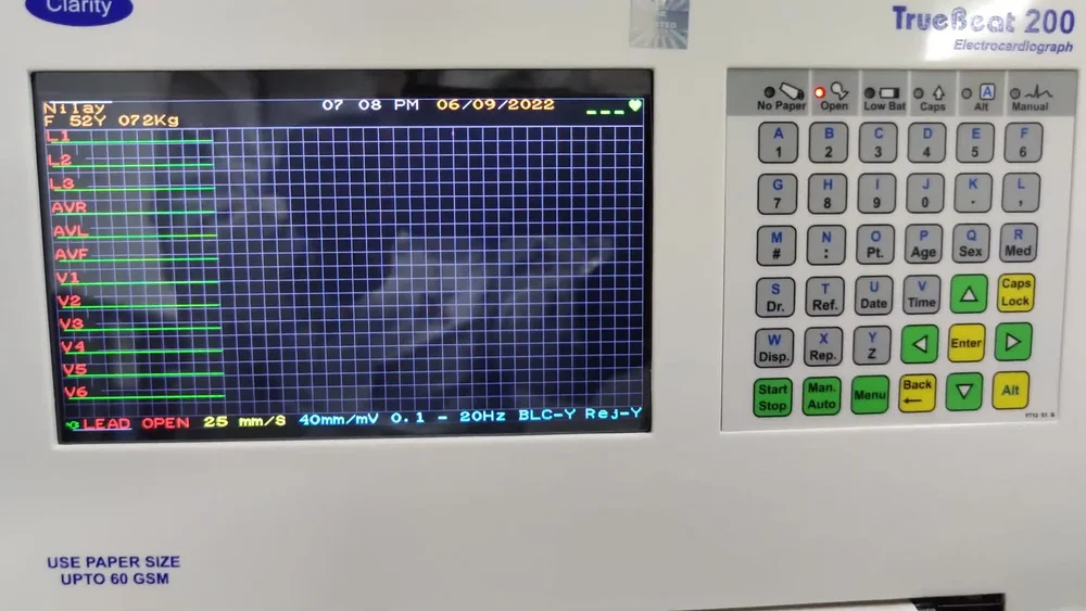 Clarity TrueBeat 200 - 12 Channel ECG Machine, Digital - Image 4